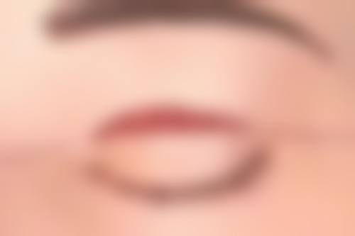 头发种植持久稳固的生长优势