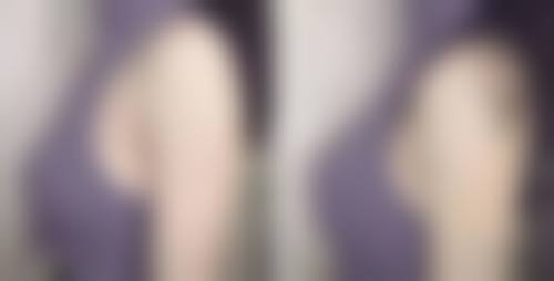 八、深圳欧维美创整形医院真实的顾客评价如下：