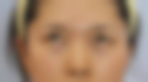 七、南昌贵美人医疗美容医院真实的顾客评价如下：