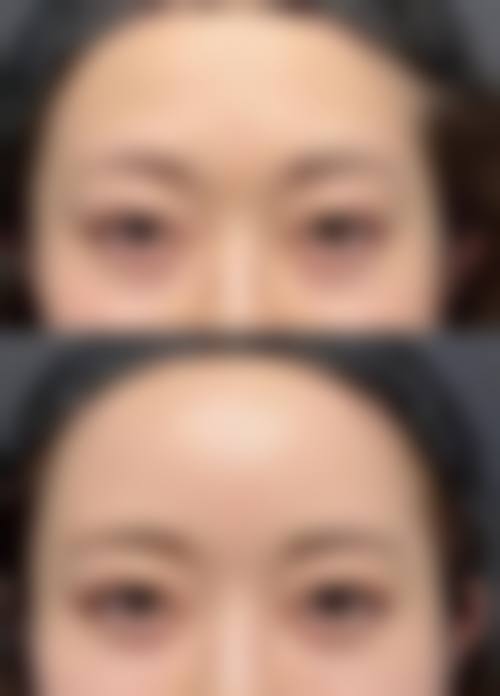 五、深圳欧维美创整形医院实例