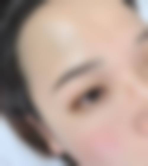 五、呼和浩特雅诗顿整形医院实例