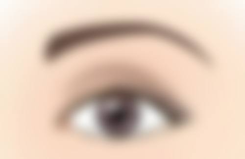 30 岁单眼皮变双眼皮原因大揭秘！遗传、老化、外力等因素逐个剖析