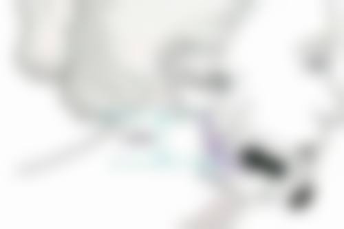 注射瘦脸针用处大揭秘！成效维持情况解析