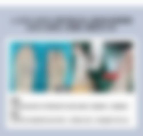 注射瘦脸针用处大揭秘！适用人群与前提条件