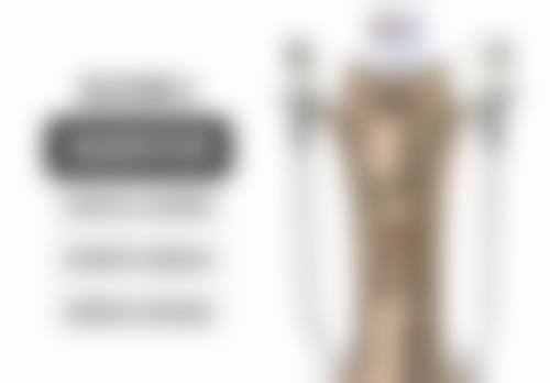 30岁单眼皮变双眼皮原因大揭秘之一过性眼睑水肿