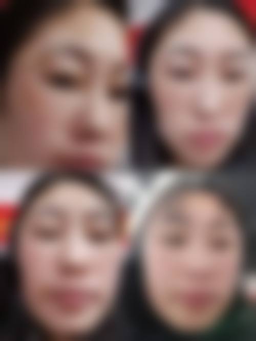 六、马鞍山市人民医院皮肤科怎么预约: