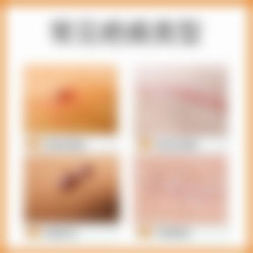 三、马鞍山市人民医院皮肤科医生介绍: