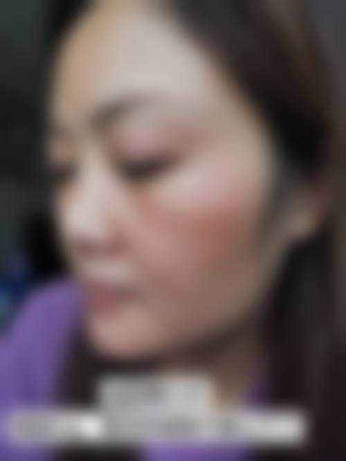 林亚红医生在哪家医院