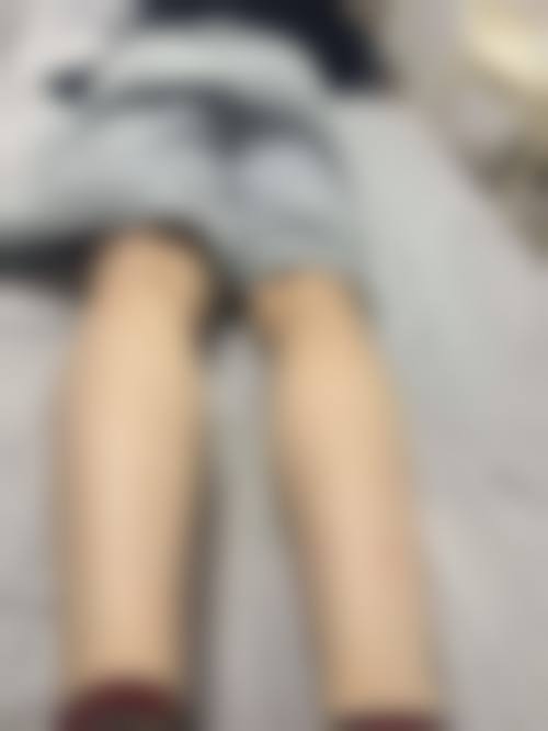 林亚红医生怎么预约？