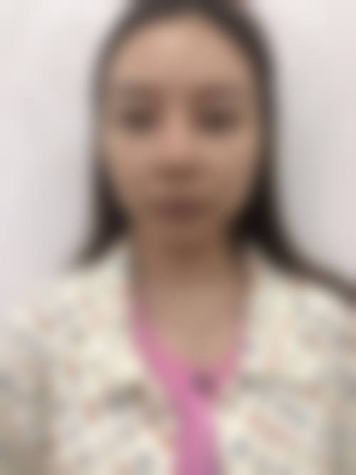 八、西安美客美芯整形医院真实的顾客评价如下：