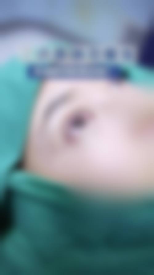 五、苏州美博士整形美容门诊部实例