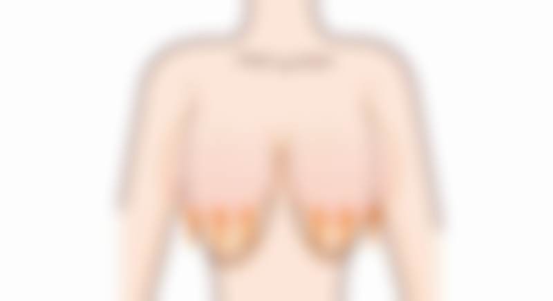 程飞医生在哪家医院