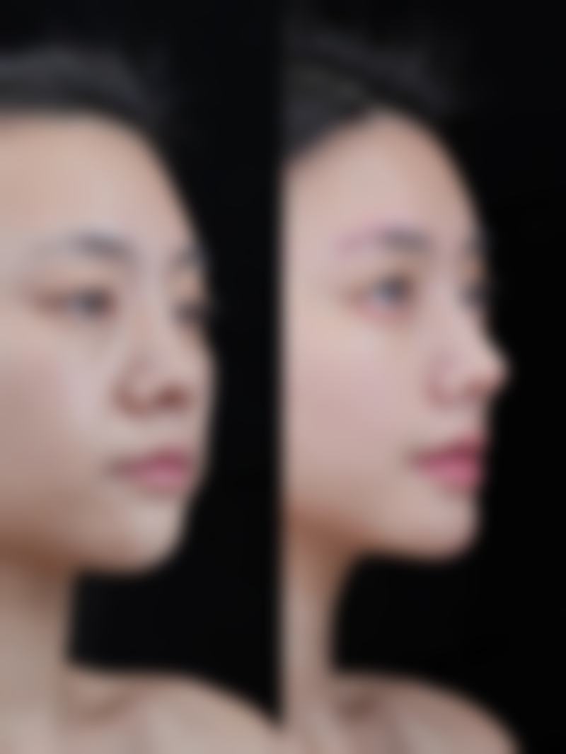 六、涿州明日昔颜整形医院怎么预约：