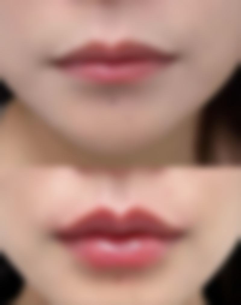 赵传森医生实例