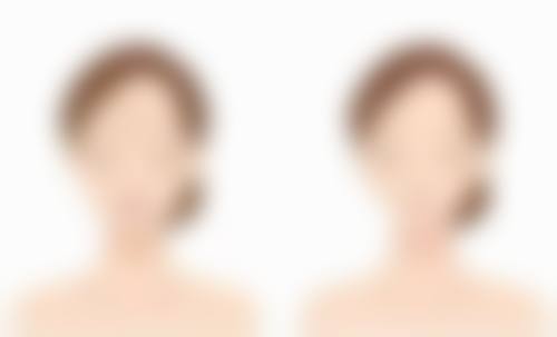 有！这些去眼袋产品超厉害，眼膜眼霜双管齐下，多种眼袋类型一网打尽 