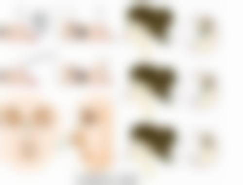 脸上黑色疤痕去除难题怎么破？多方法结合，从根源淡化色素、改善疤痕状况