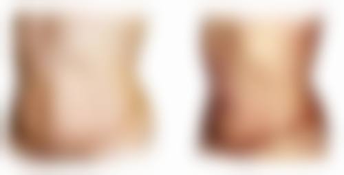 脸上黑色疤痕去除难题怎么破？手术治疗有妙招