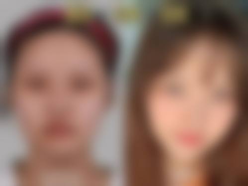 七、武汉美妍高科医疗美容门诊部价格表:(仅供参考)