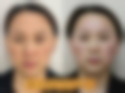 四、杭州倍肤丽医疗美容诊所开展的主要项目和特色项目