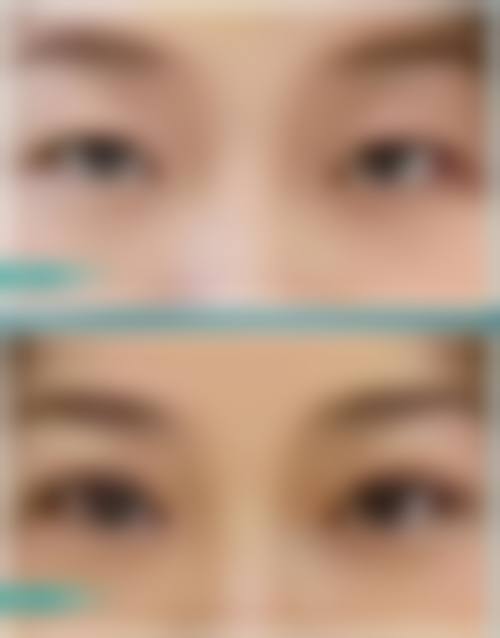 四、徐州丽尔美医疗美容门诊部实例