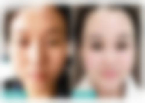 三、深圳德仕妮医疗美容门诊部医生介绍: