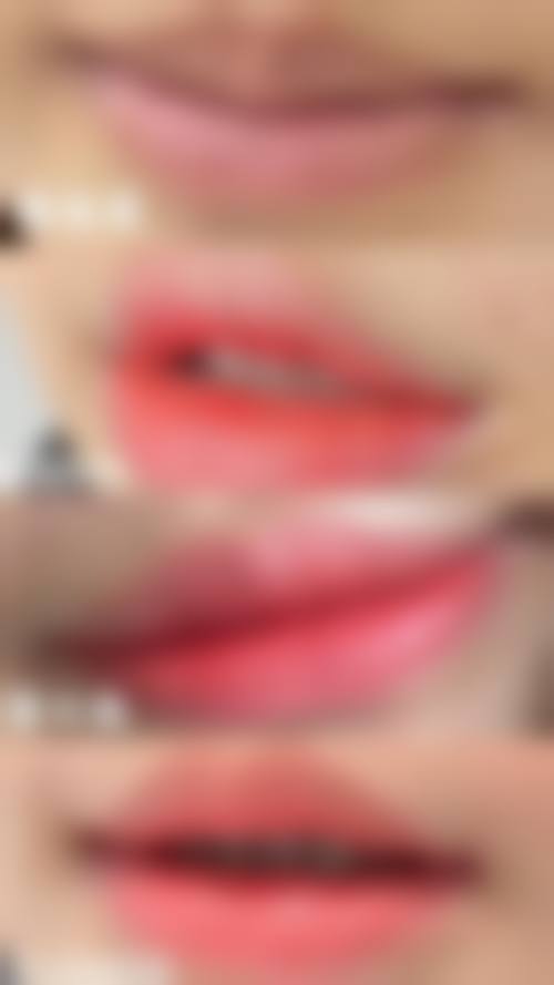 七、东莞天瑜医疗美容门诊部价格表：（仅供参考）