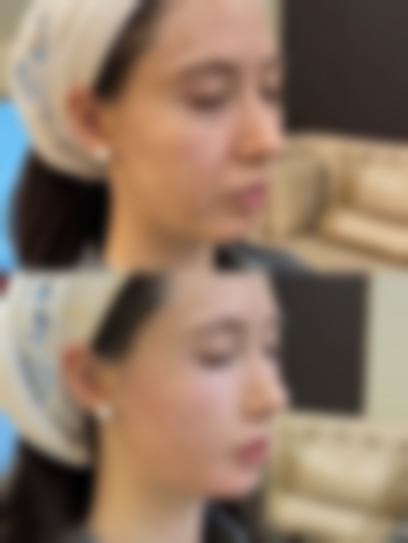 适度睁眼应避免过度用力