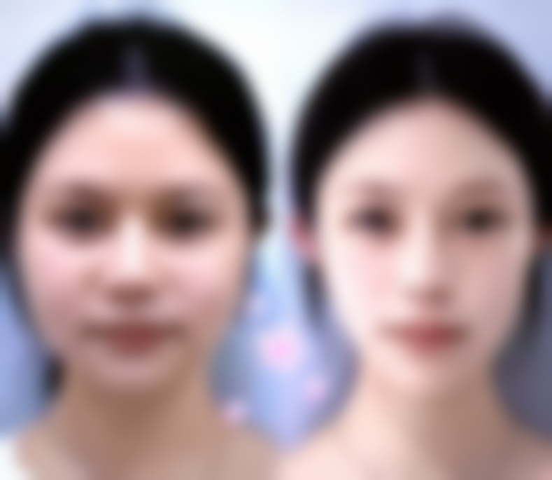 五、北京伊美尔幸福美容专科医院实例