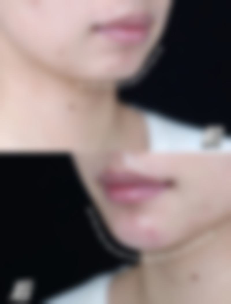 袁志宇医生在哪家医院怎么预约？