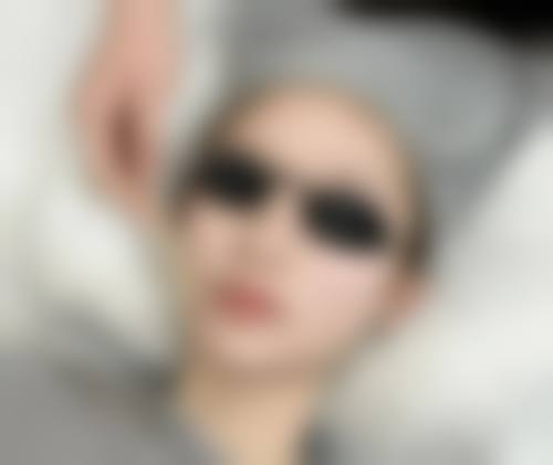 五、淮北奥斯曼整形医院实例