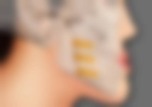 骨干医生怎么看割过的双眼皮疤痕修复？听听专精建议