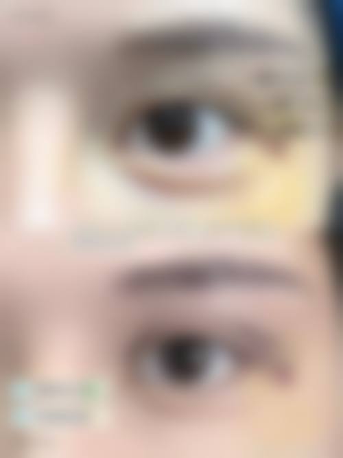 七、爱缇思医疗美容价格表：（仅供参考）