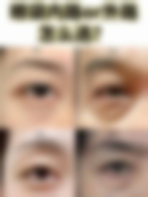 八、淮北奥斯曼整形医院真实的顾客评价如下：