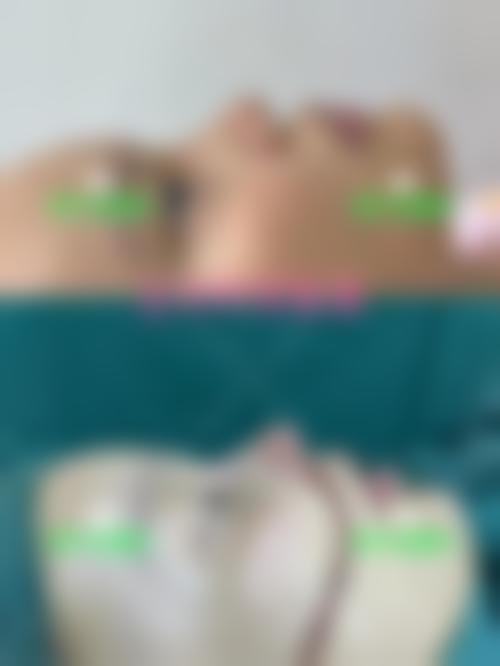 七、杭州幸福绽放整形医院价格表：（仅供参考）