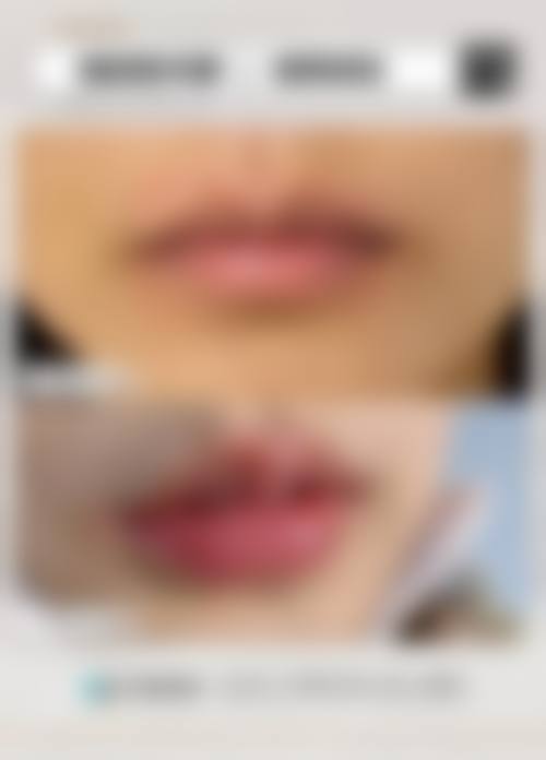 六、成都青羊鸥罗娜整形医院价格表：（仅供参考）