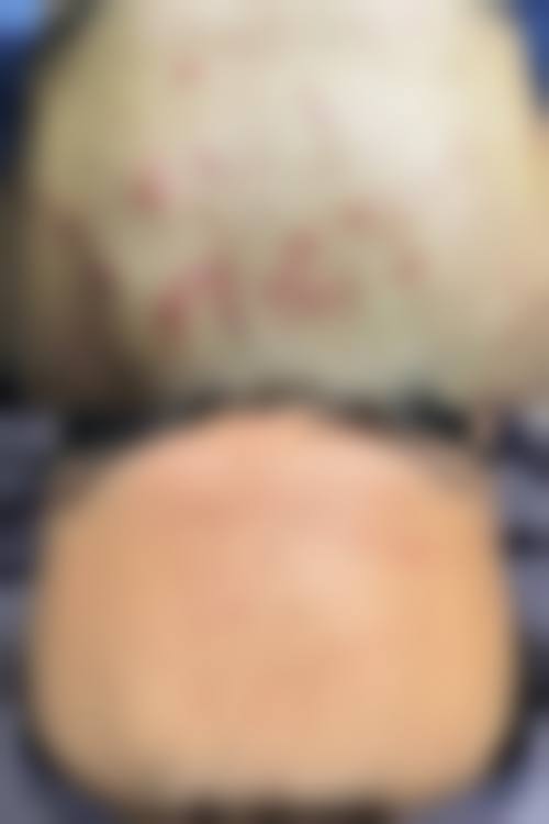 八、常德市第一人民医院皮肤性病科真实的顾客评价如下：