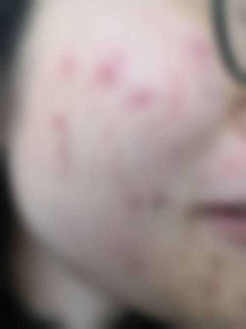 七、常德市第一人民医院皮肤性病科价格表：（仅供参考）