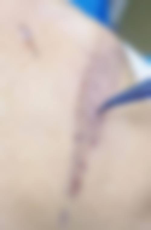 五、成都青羊鸥罗娜整形医院怎么预约：