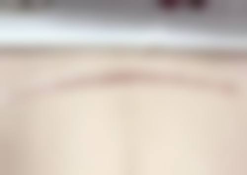 郅丹丹医生怎么样可靠吗？