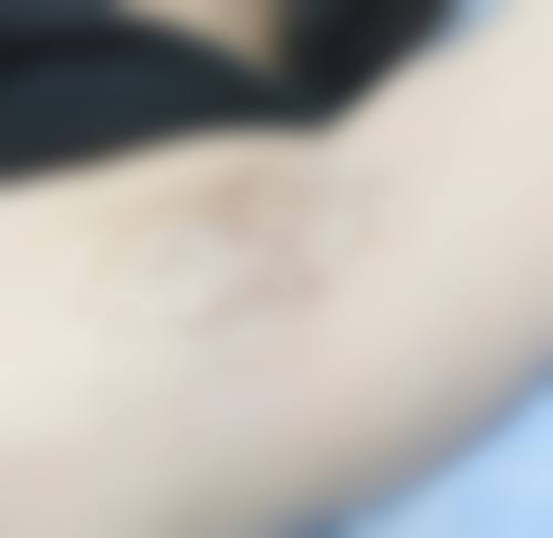 七、来安县德尔美客医疗美容门诊部真实的顾客评价如下：