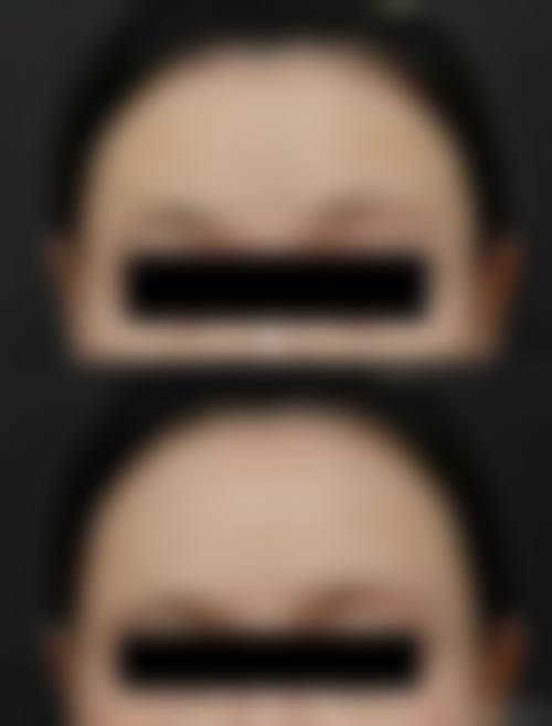 七、太原脸蛋汇咖医疗美容诊所价格表：（仅供参考）