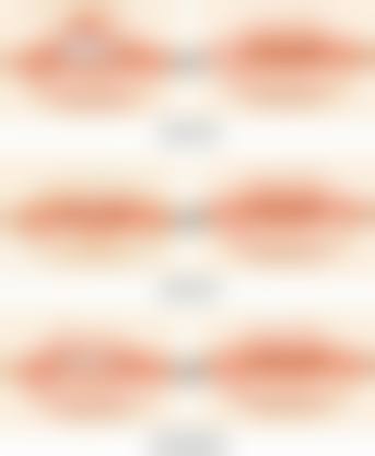 七、成都青羊鸥罗娜整形医院真实的顾客评价如下：