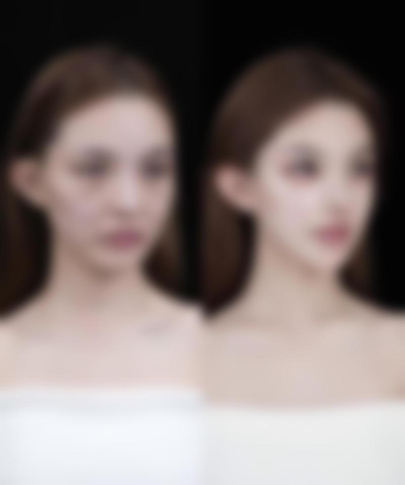 割过的双眼皮疤痕修复前景如何？未来值得期待