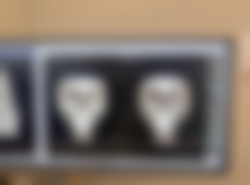 隆鼻哪种材料更自然？膨体聚四氟乙烯的独特魅力