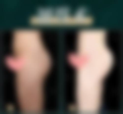 方锦平医生怎么样可靠吗？