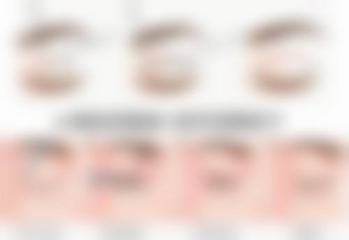 硅胶假体隆胸取出/更换指征：何时需要行动