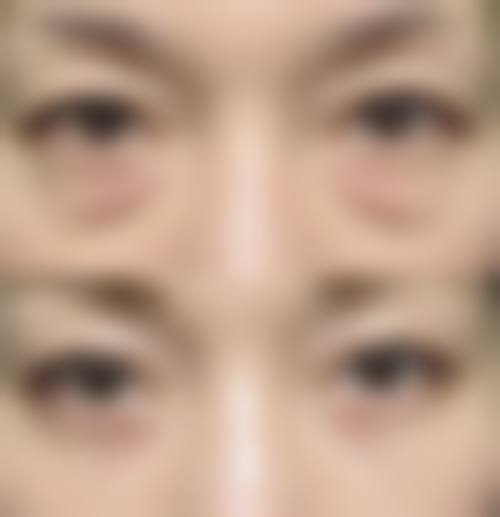 七、滨州丽都爱容整形美容医院价格表：（仅供参考）