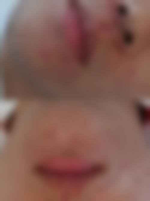 六、南宁首大医院皮肤医学美容中 心怎么预约：