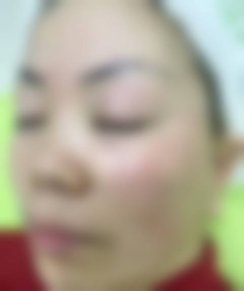 三、高要市人民医院整形激光美容科医生介绍: