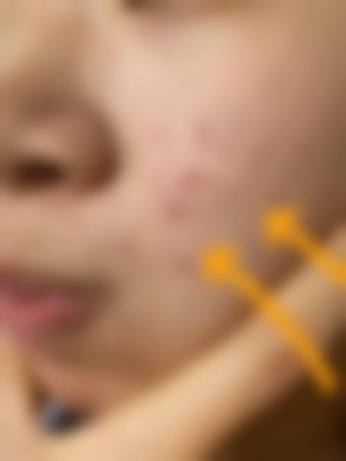 三、空军第九八六医院皮肤烧伤整形科（西 京医院九八六医院）医生介绍: